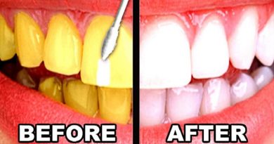 TEETH HACKS