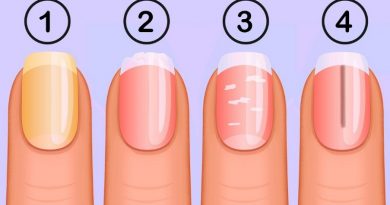 What Your Nails Say About Your Healt